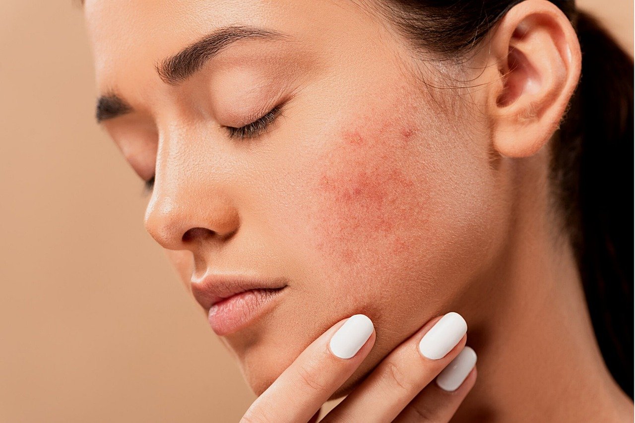 Pearl Skin Clinic Ranchi