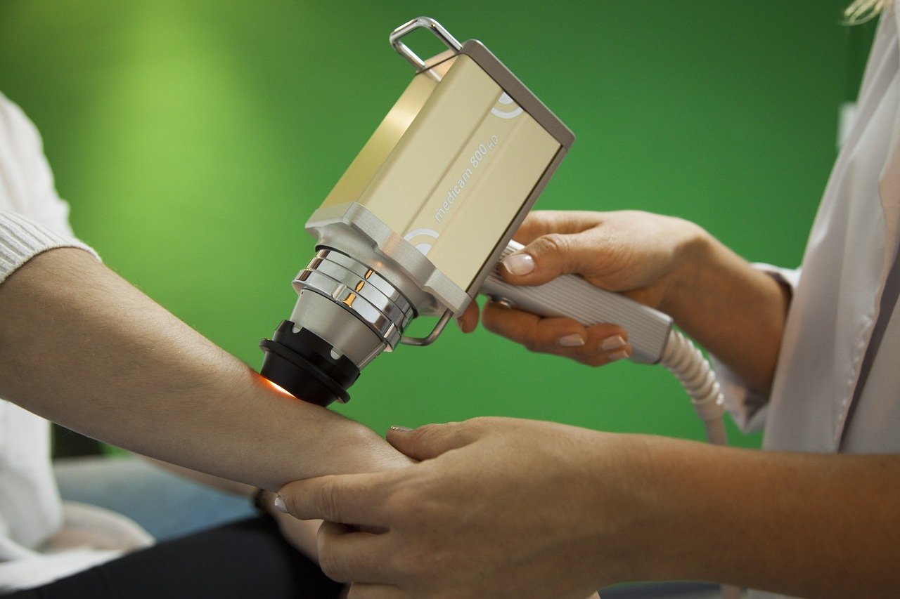 qswitch Treatment in Ranchi