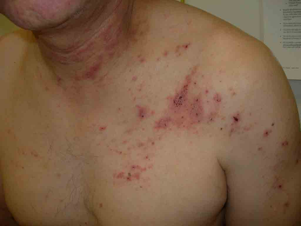 Pearl Skin Clinic Ranchi
