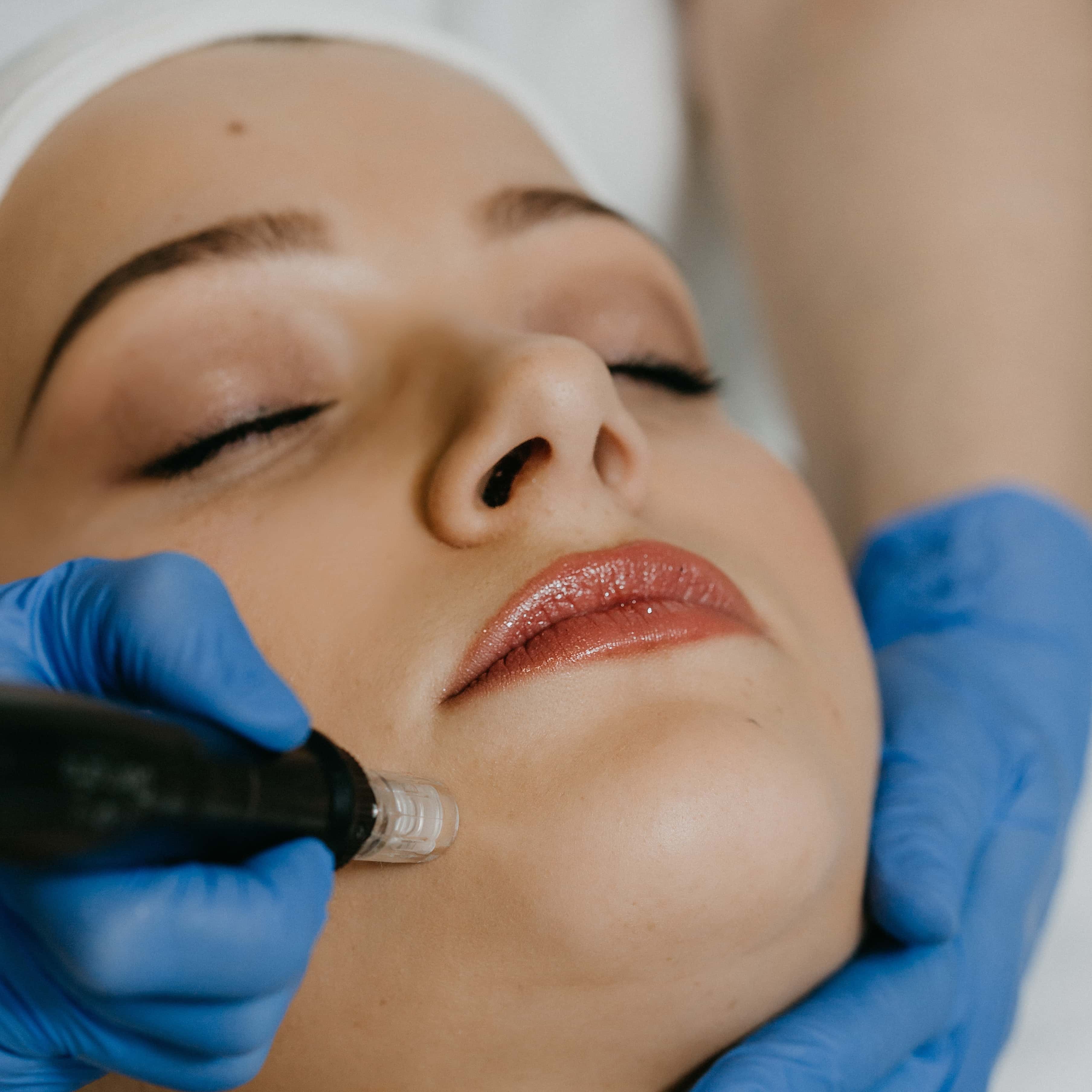 Laser Toning Treatment in Ranchi