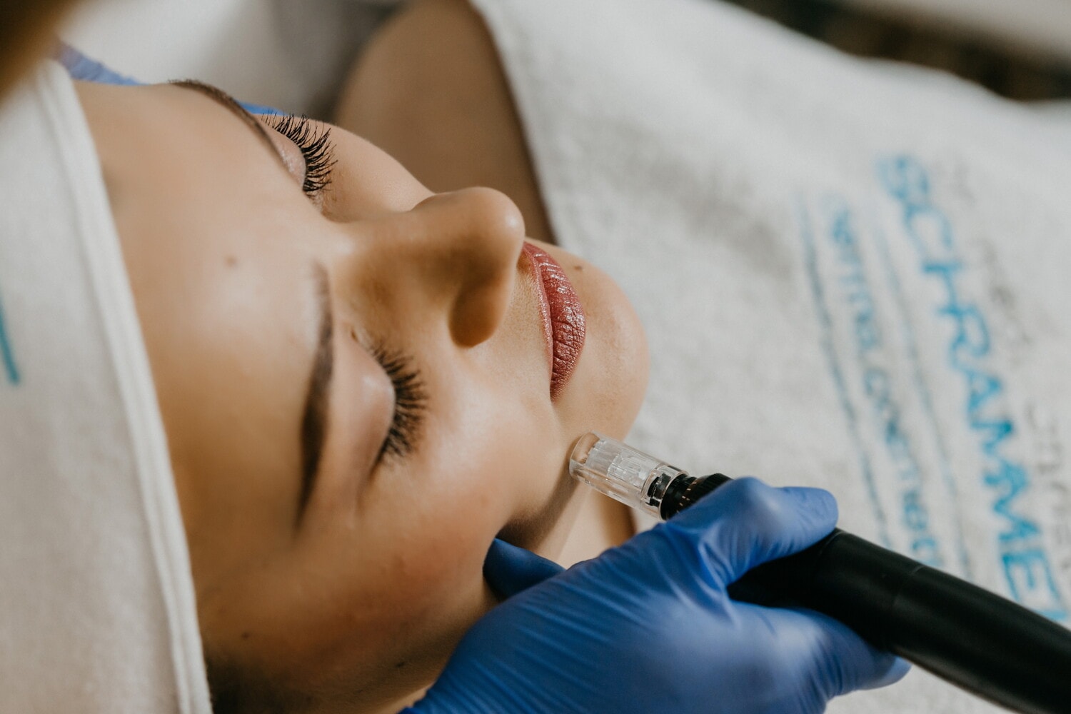 Laser Toning Treatment in Ranchi