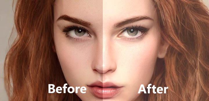 Skin Lightening Treatment in Ranchi